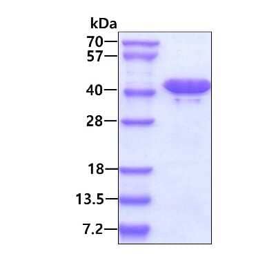 SDS-PAGE: Recombinant Human BPNT1 His Protein [NBP1-50964]